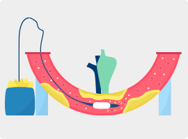 Understand Calcium Management